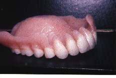 PRTESE ACRLICA SUPERIOR